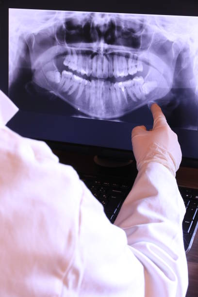 Best Broken or Chipped Tooth Repair in Big Pine Key, FL