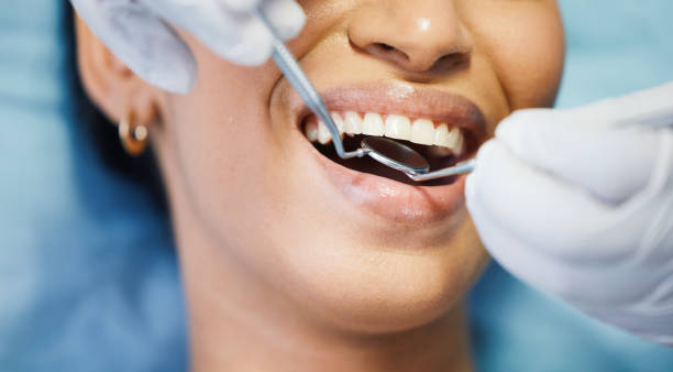 Best Emergency Wisdom Tooth Extraction in Big Pine Key, FL